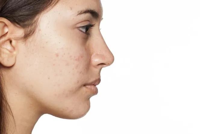 Zapchana cera jak wygląda - rozpoznaj objawy i uniknij problemów