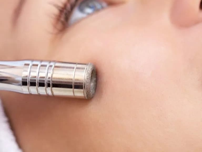 Jak często robić mikrodermabrazję, by uniknąć uszkodzeń skóry?