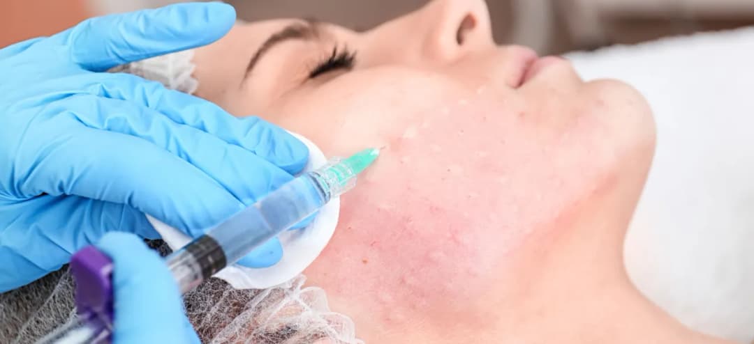 Co rozpuszcza kwas hialuronowy? Poznaj skuteczne metody i substancje